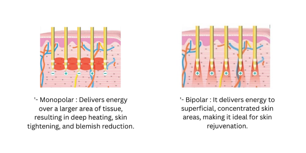 Potenza RF Microneedling  Monopolar & Bipolar